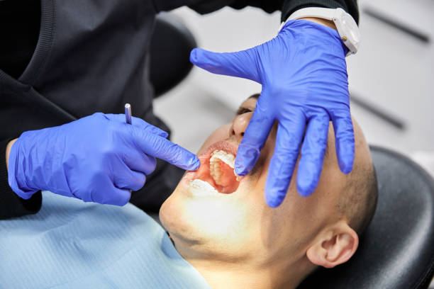 Best Emergency Dental Care for Broken or Chipped Teeth in Stanton, TX