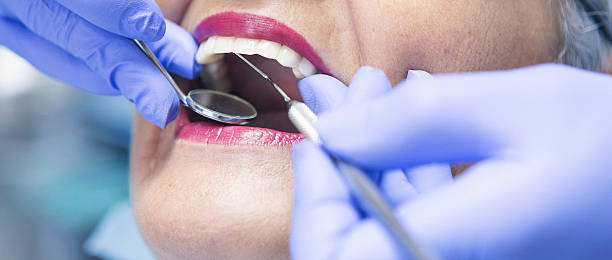 Best Urgent Care for Lost Fillings or Crowns in Stanton, TX